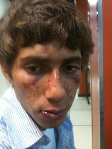 lesão Corporal ou Tentativa de Homicídio?
